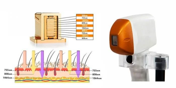 Principle Of Laser Hair Removal Treatment